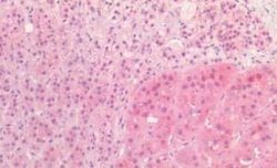 Proenkephalin Antibody, Novus Biologicals 50 &mu;g; Unconjugated:Antibodies,